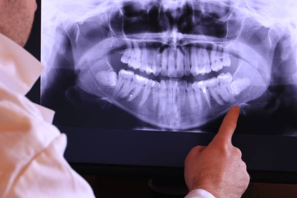 Best Mobile Emergency Dentist in Apalachicola, FL